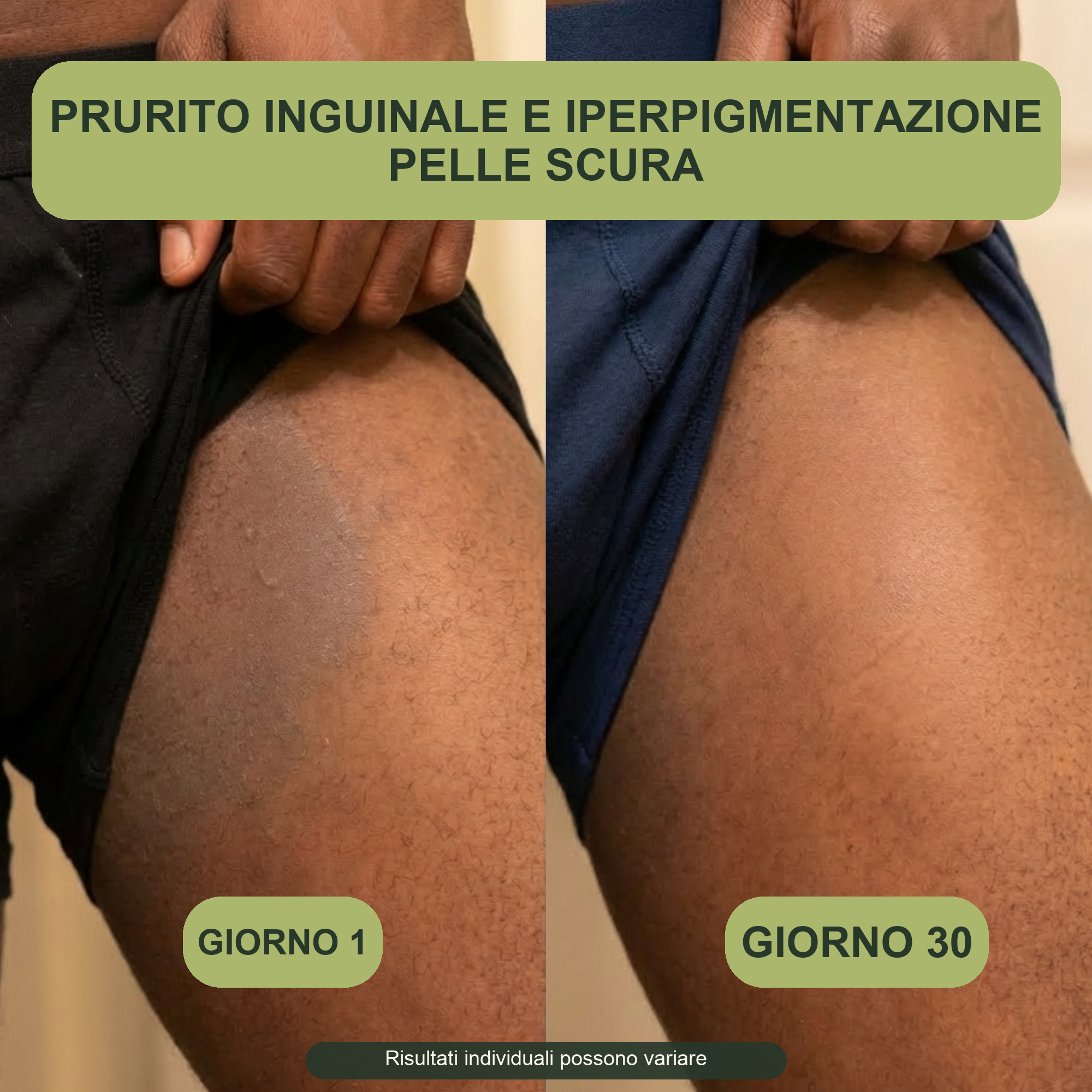 Esperienza del prodotto su pelle scura